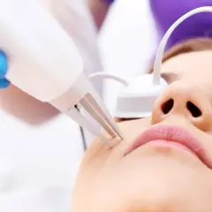 Persona recibiendo depilación láser en el bigote. Un profesional con guante azul usa un dispositivo para el tratamiento.