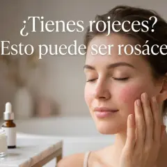 Mujer con mejillas enrojecidas, posible rosacea. Cuidado de la piel con crema y sérum.