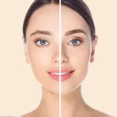 Comparación de cejas: antes, con microblading mal hecho, y después, con cejas perfectas.