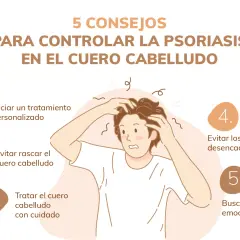 Consejos para controlar la psoriasis en el cuero cabelludo: tratamiento, evitar rascar, cuidado, desencadenantes y apoyo emocional.