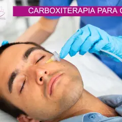 Un profesional aplica carboxiterapia para ojeras a un hombre. El tratamiento mejora la apariencia de la piel.