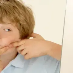 Limpieza facial niños 11 años: Cuida su piel y evita el acné