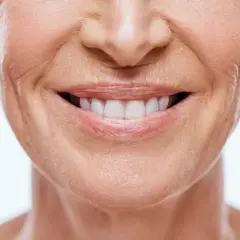 Sonrisa radiante con surcos nasogenianos marcados, piel madura y dientes blancos.