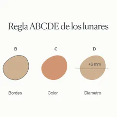 Regla ABCDE para identificar lunares malignos: Asimetría, Bordes irregulares, Color variado, Diámetro mayor a 6mm y Evolución.