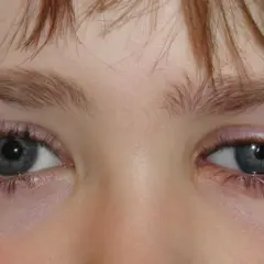 Ojos hundidos de un niño, con pestañas largas y cejas finas.