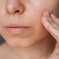 Primer plano de una cara con piel grasa, mostrando la textura brillante y la mano tocando suavemente la mejilla.