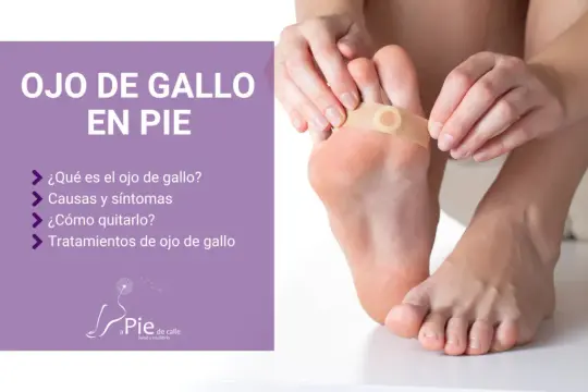 Persona aplica un parche para tratar un ojo de gallo en el pie. El texto informa sobre el ojo de gallo en el pie.