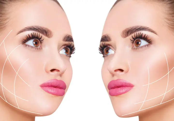 Dos rostros femeninos con líneas de contorno facial, sugiriendo tratamientos estéticos para el "ozempic face".
