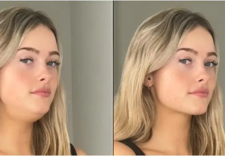 Comparación de antes y después de una mujer. A la izquierda, se ve un doble mentón. A la derecha, tras aplicar la técnica de **que es mewing**, su mandíbula luce más definida.