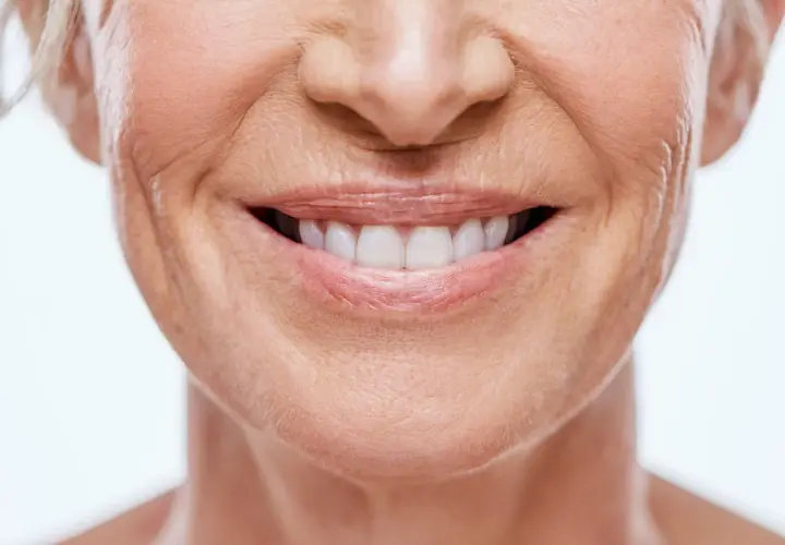 Sonrisa radiante con surcos nasogenianos marcados, piel madura y dientes blancos.
