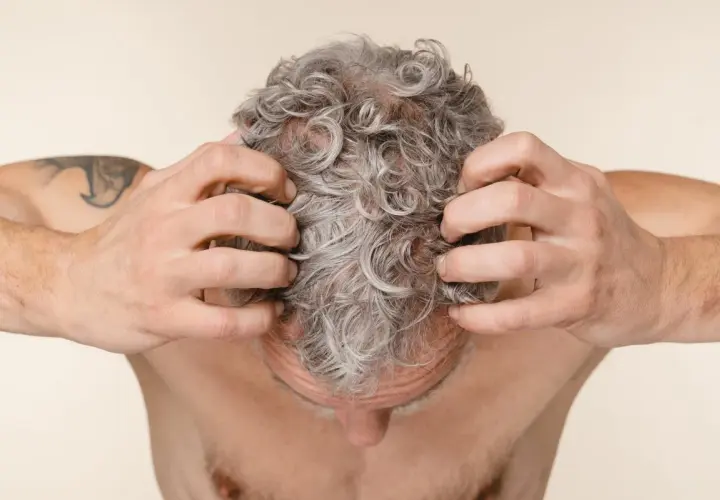 Hombre rascándose el cuero cabelludo con pelo gris y rizado.