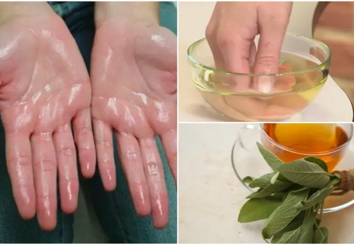 Manos sudorosas por hiperhidrosis palmar. Un dedo en un cuenco con líquido y una taza de té de salvia.