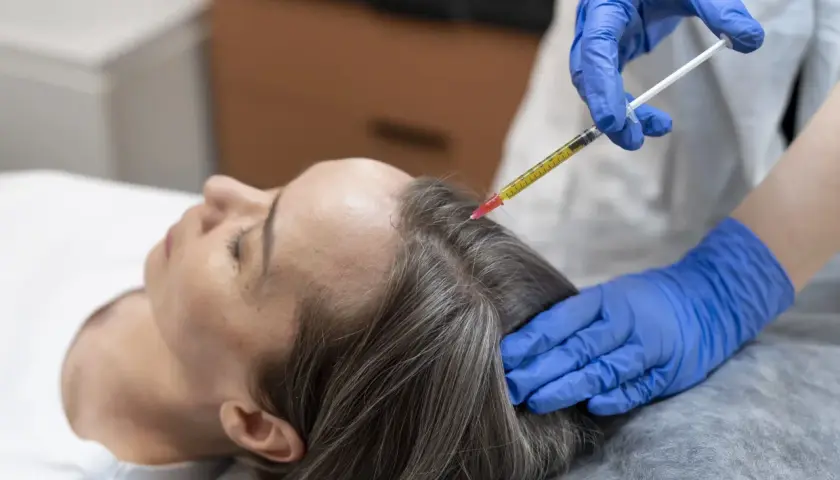 Una mano con guante azul aplica una inyección en el cuero cabelludo de una mujer, buscando aliviar el dolor y mejorar la salud capilar.