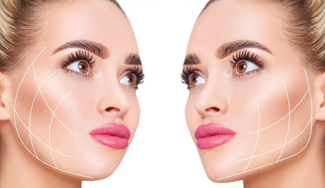 Dos rostros femeninos con líneas de contorno facial, sugiriendo tratamientos estéticos para el "ozempic face".