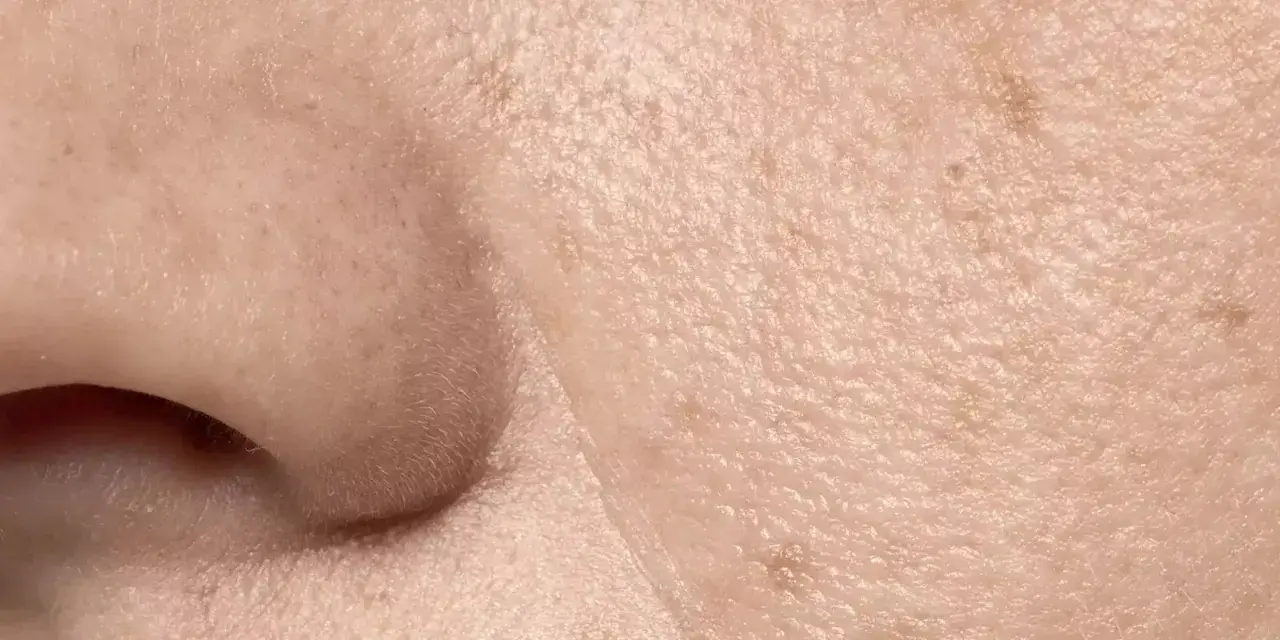 Primer plano de la piel, mostrando la textura y los poros visibles. Se aprecian pequeñas imperfecciones y la delicada superficie.