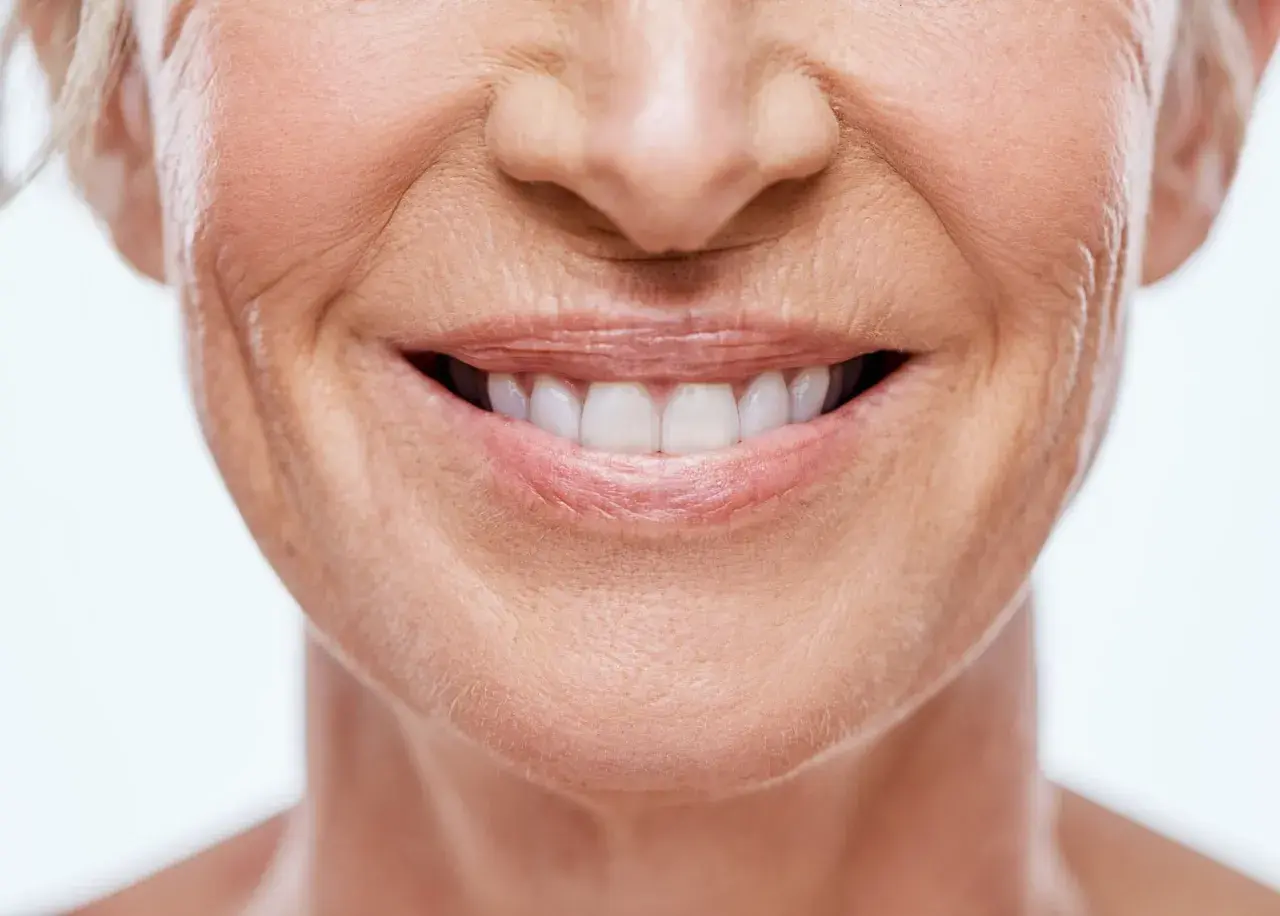 Sonrisa radiante con surcos nasogenianos marcados, piel madura y dientes blancos.
