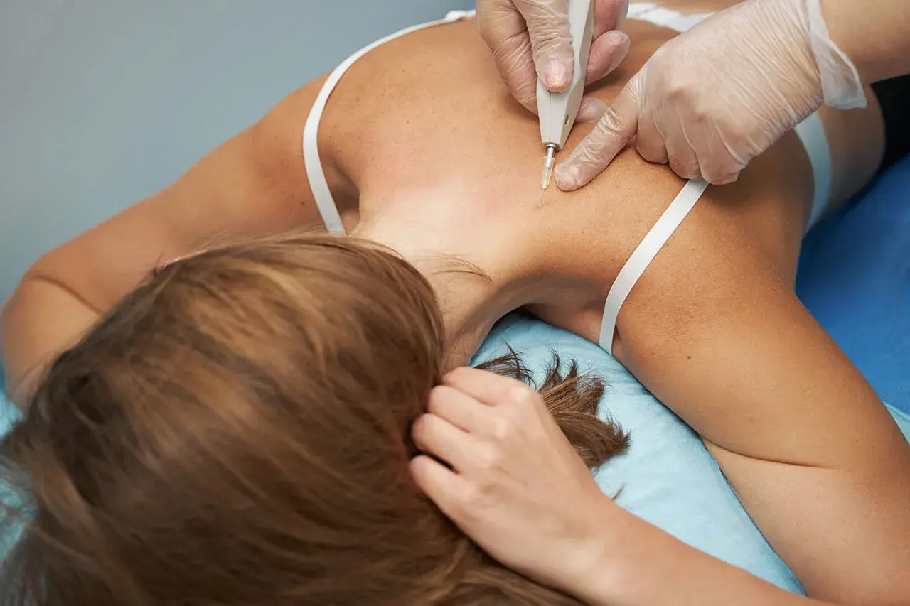 Profesional aplica carboxiterapia corporal en la espalda de una mujer.