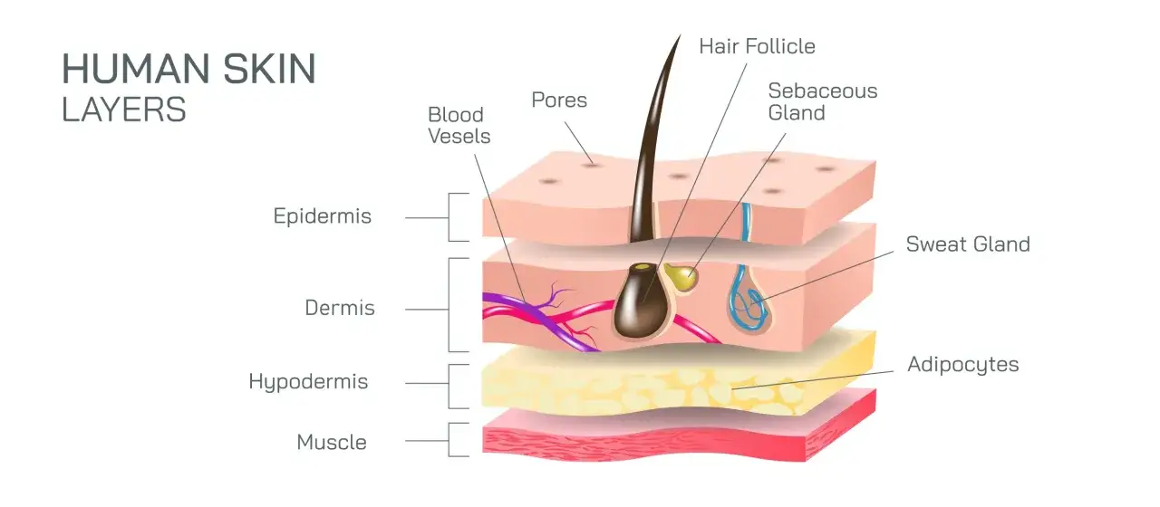 Corte transversal de la piel humana mostrando epidermis, dermis con vasos sanguíneos y folículo piloso, hipodermis y músculo.