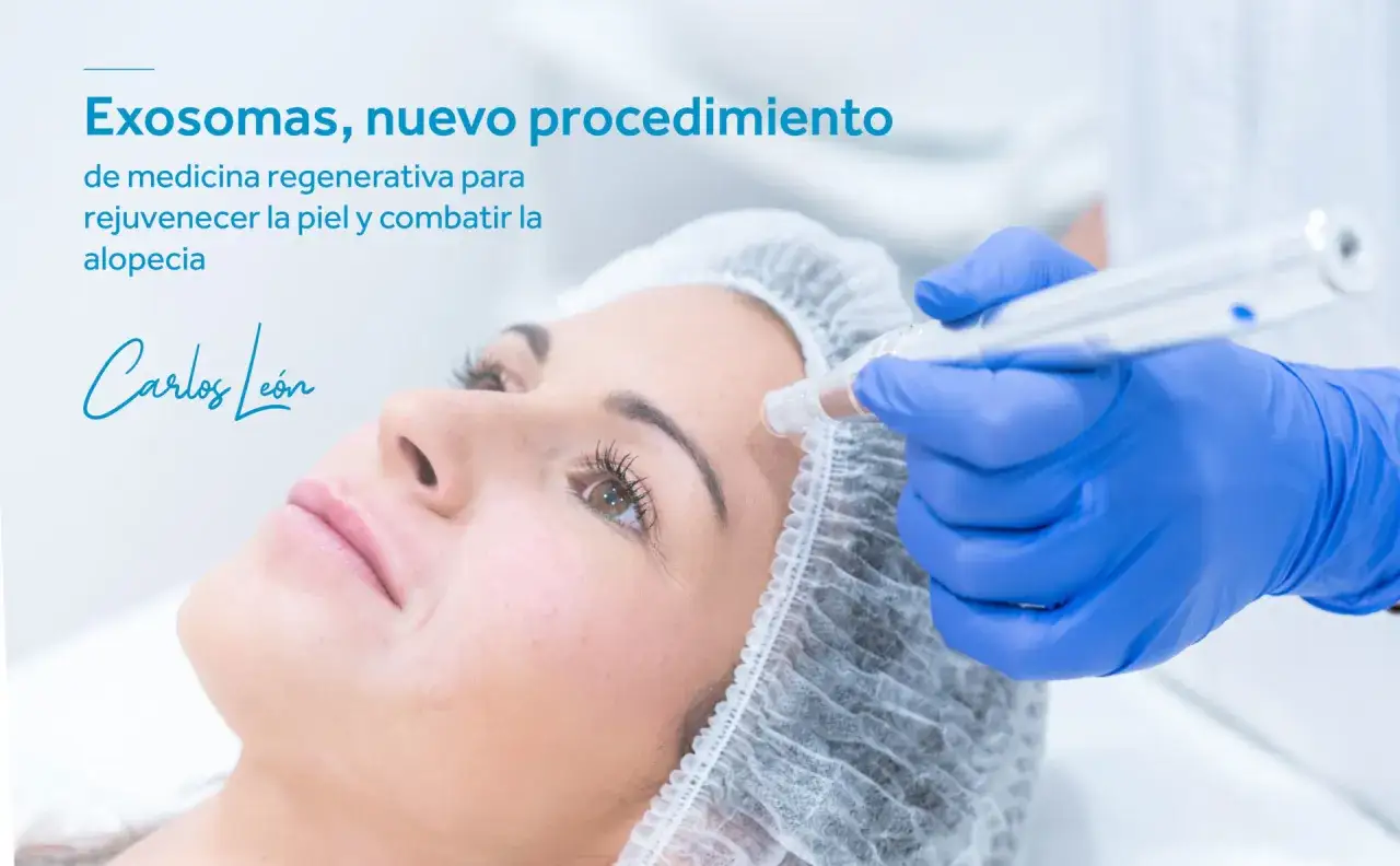 Procedimiento con exosomas para rejuvenecer la piel y combatir la alopecia. Medicina regenerativa.