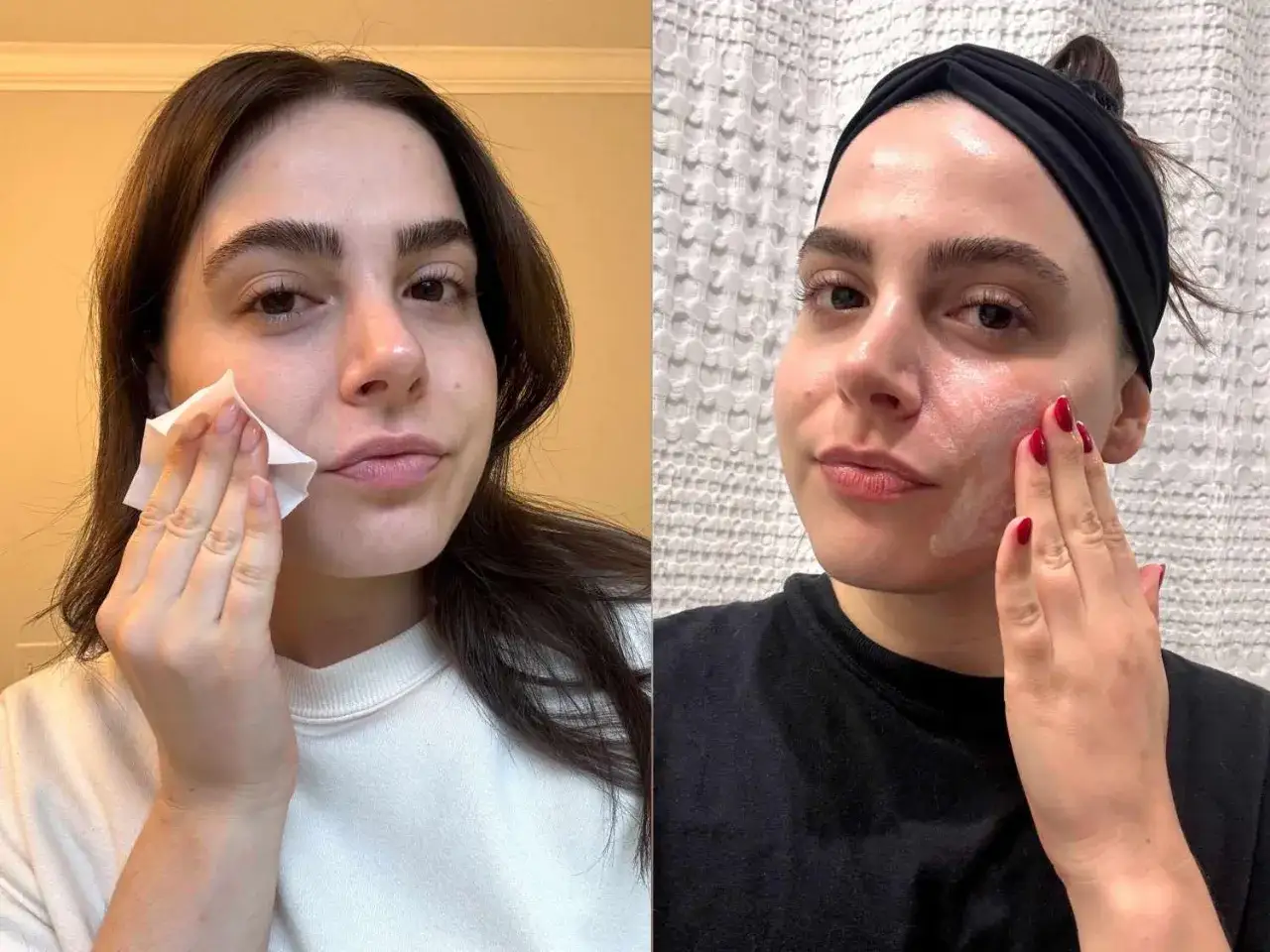 Mujer se limpia el rostro con una toallita y luego se aplica crema, parte de su rutina para quitar puntos negros.