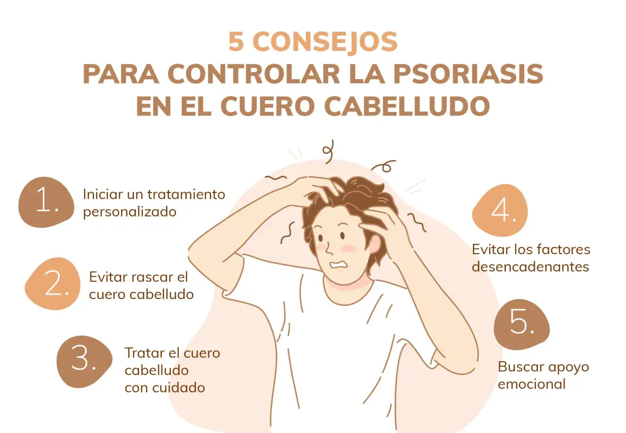 Consejos para controlar la psoriasis en el cuero cabelludo: tratamiento personalizado, evitar rascar, cuidado, evitar desencadenantes y buscar apoyo.